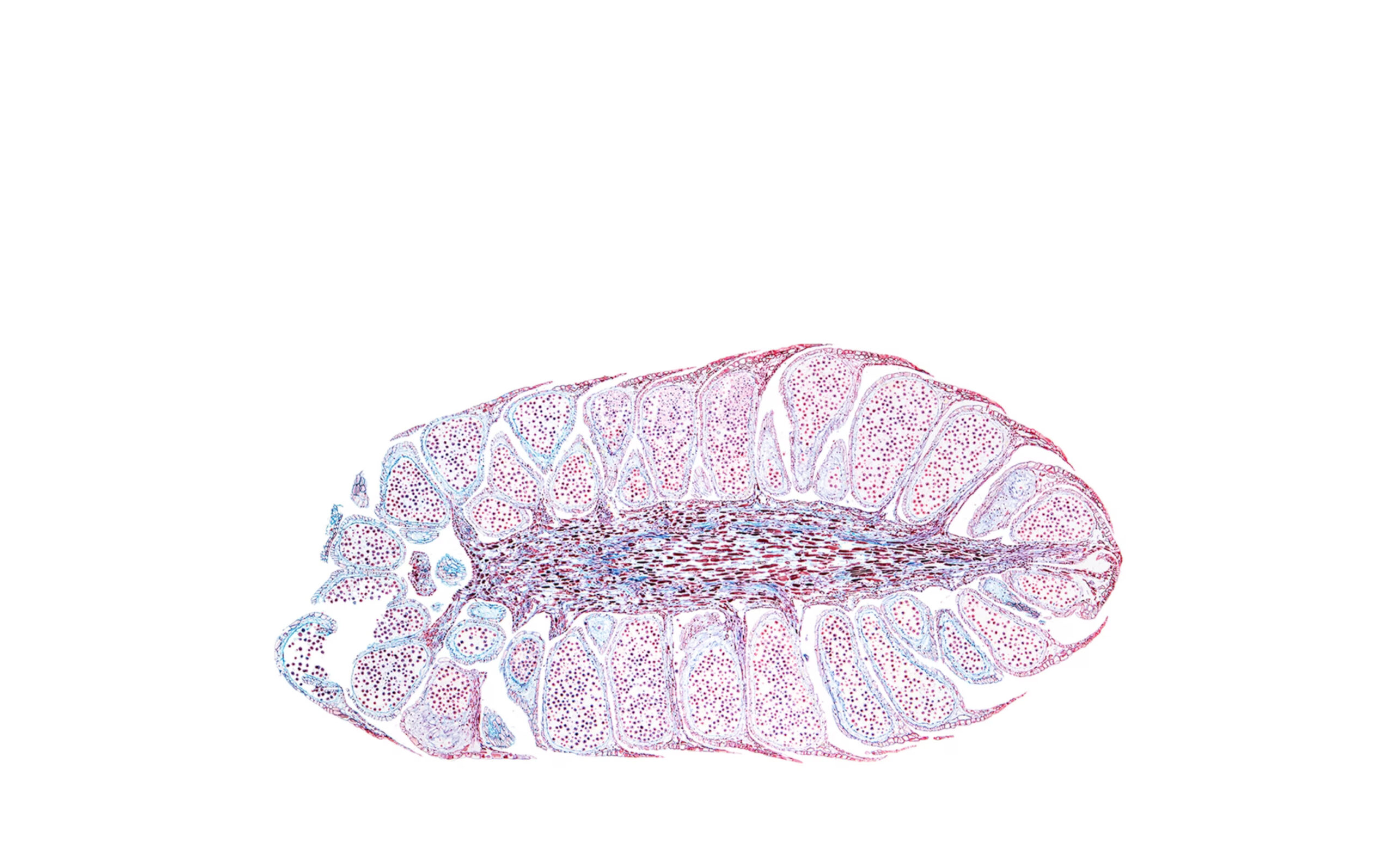 STOCKPKG_MJ8868_S074_Pinus-pan94-105